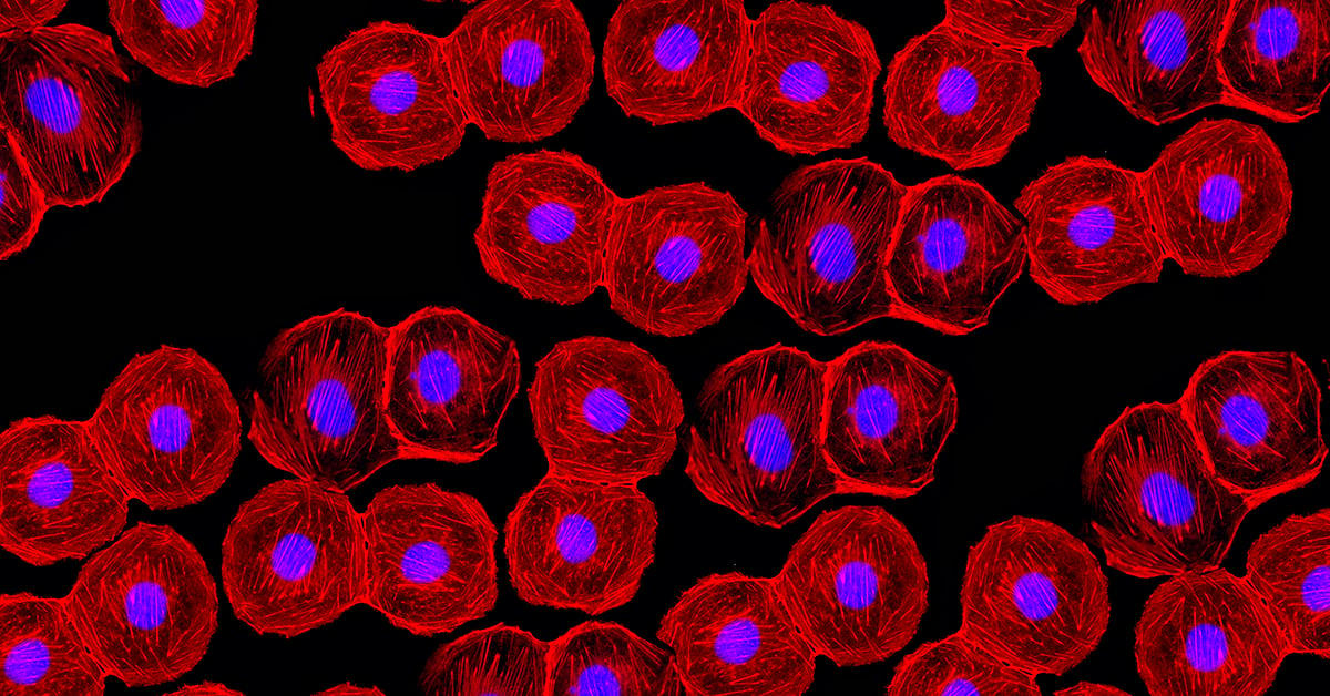 Stained Stem Cells